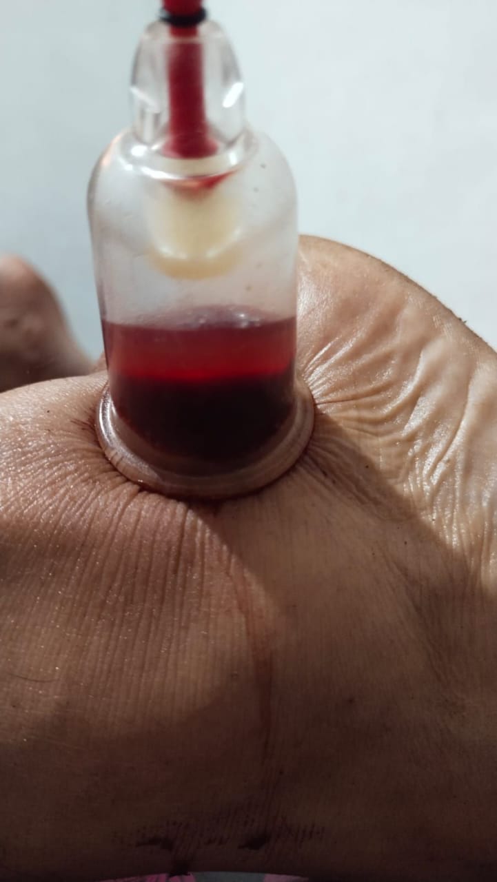 AYUR WELLNESS MANJERI