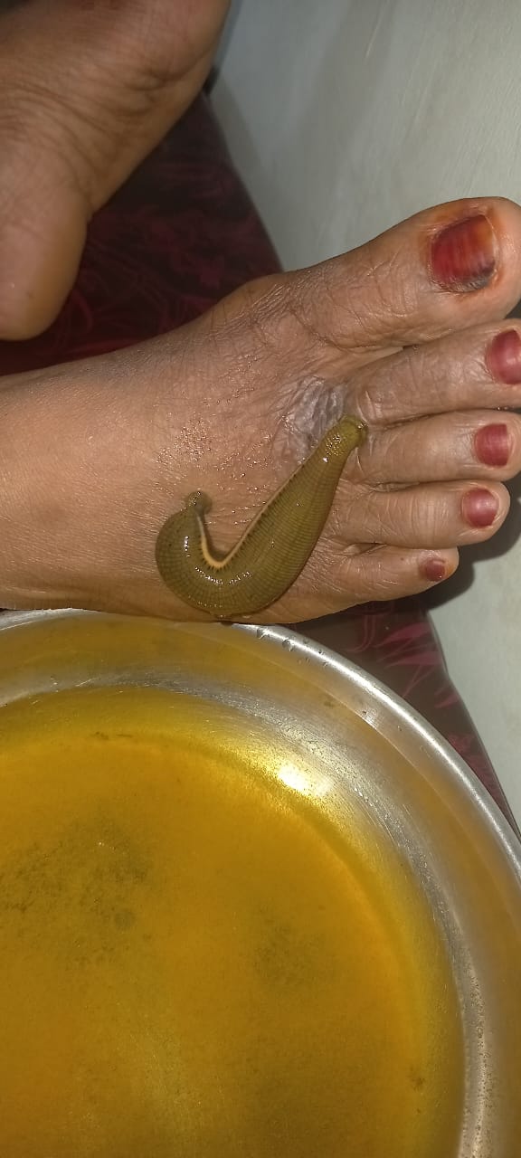 AYUR WELLNESS MANJERI